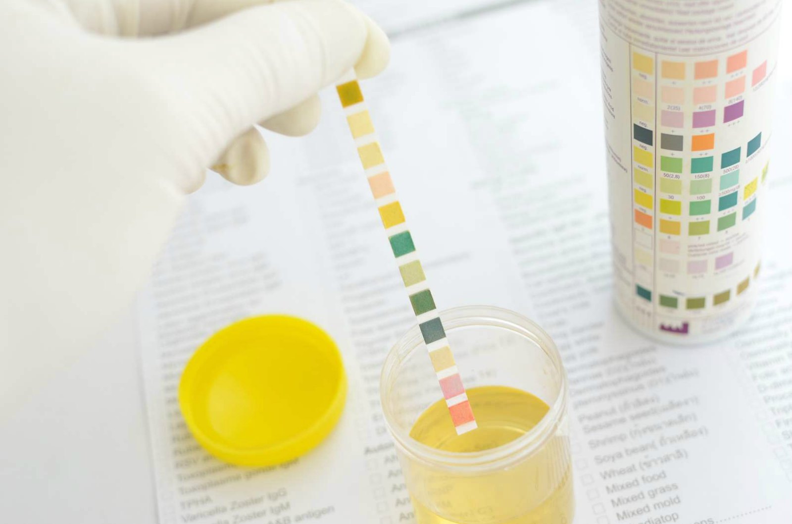 Advanced Urine-Testing System Delivers Test Results in Hours