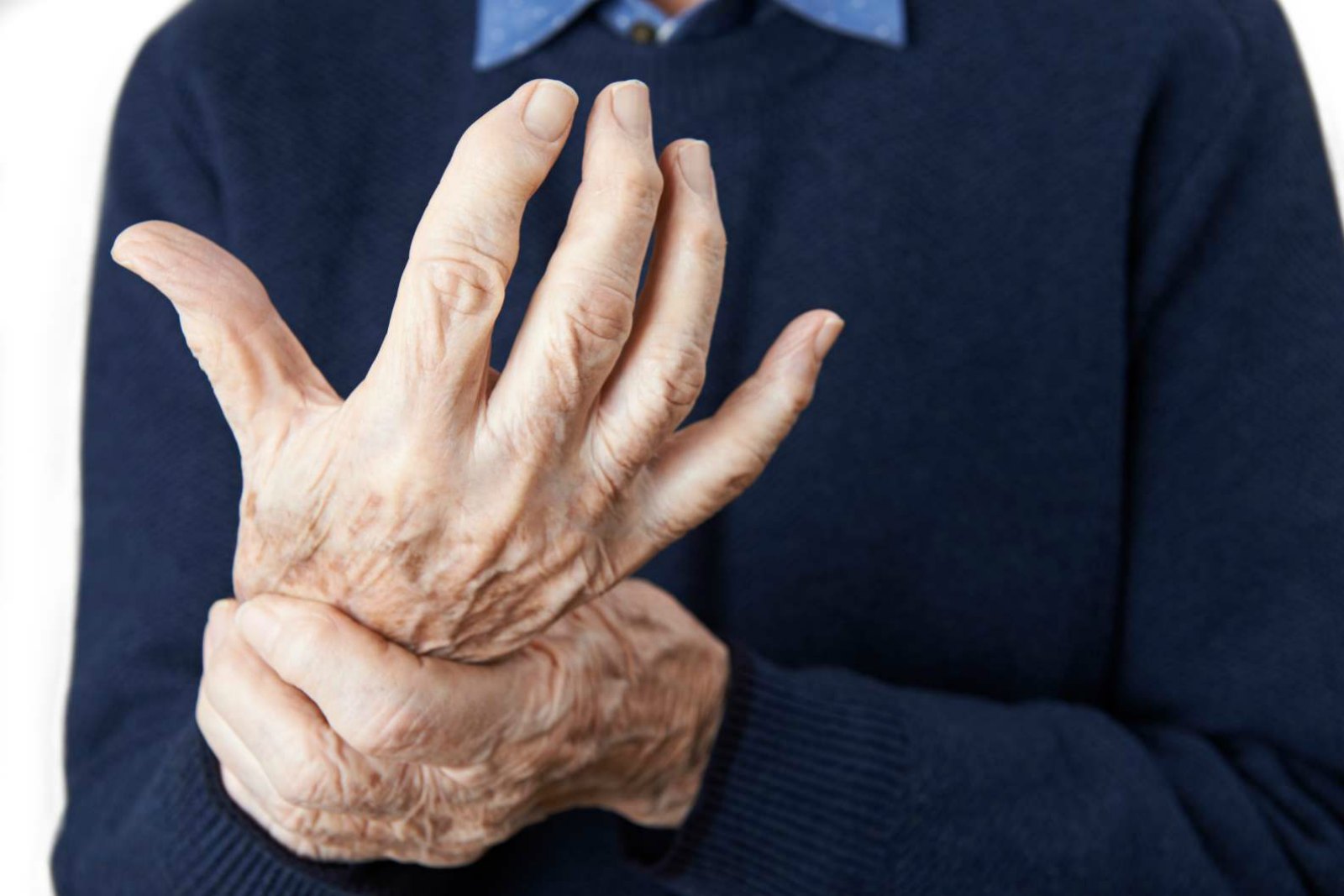 Etanercept Helps Those Suffering from Rheumatoid Arthritis