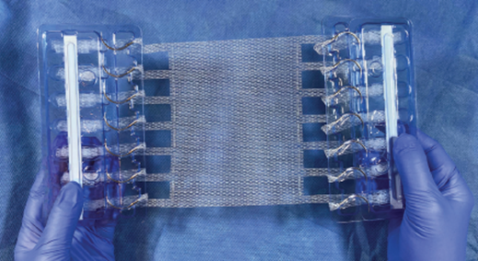 Holding It Together: How a Smarter Mesh Is Reinventing Hernia Surgery
