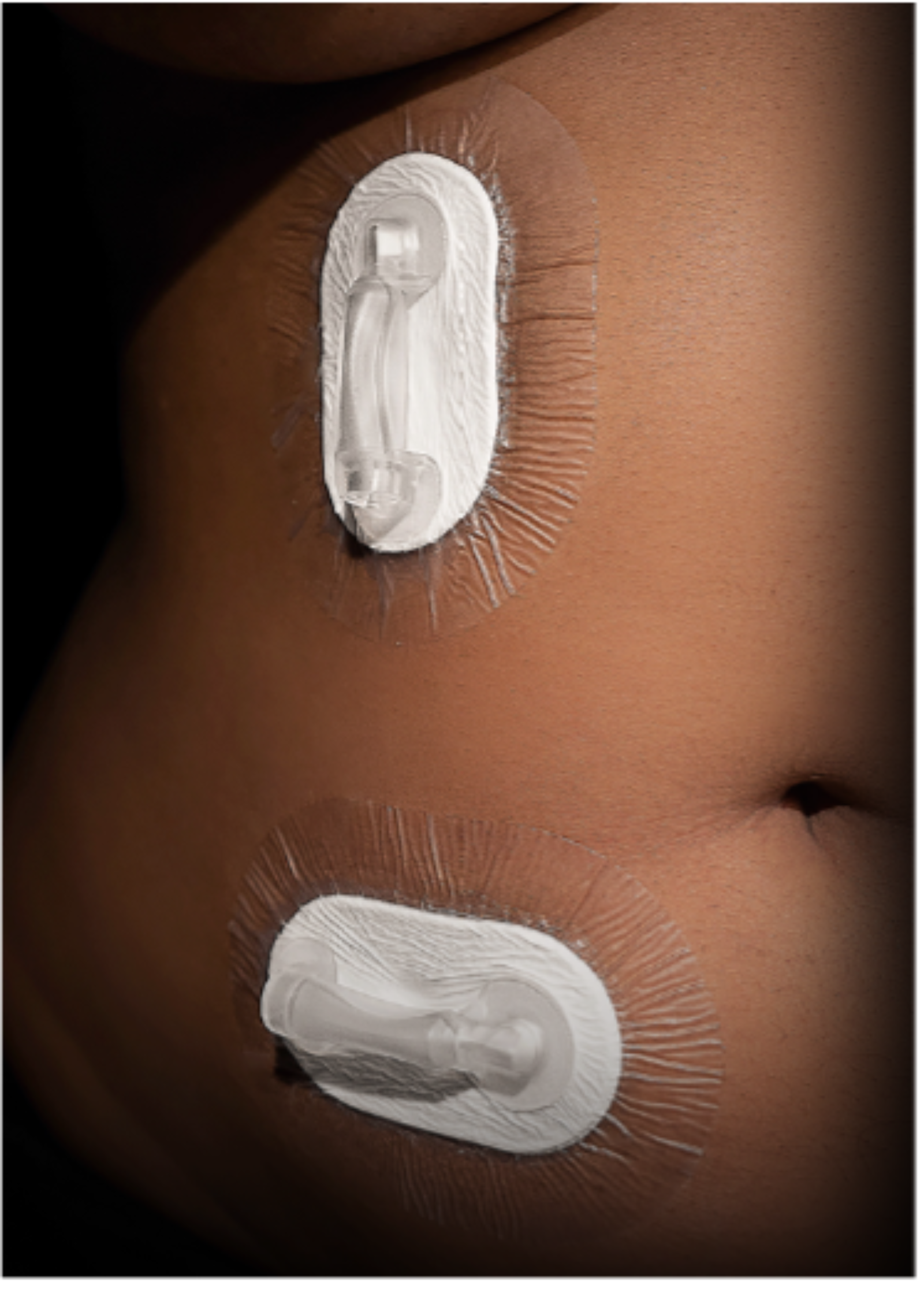 High-Tech Healing in a Simple Patch, a Weill Cornell Medicine Innovation