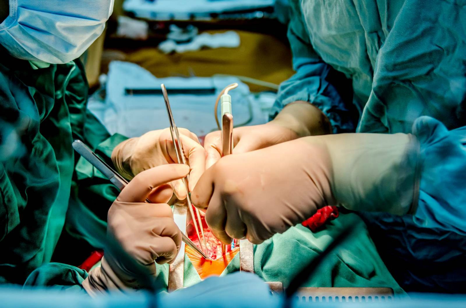 Bio-Material Improves Heart Surgery Outcomes