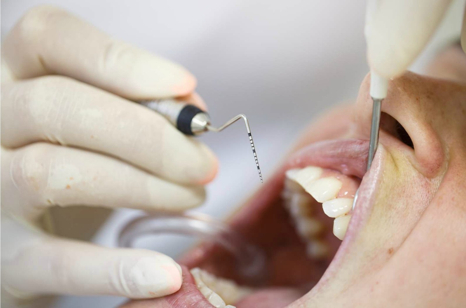 Dental Research Yields Powerful Product in the Fight Against Periodontal Disease