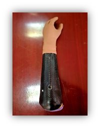 Myobionic Hand 3
