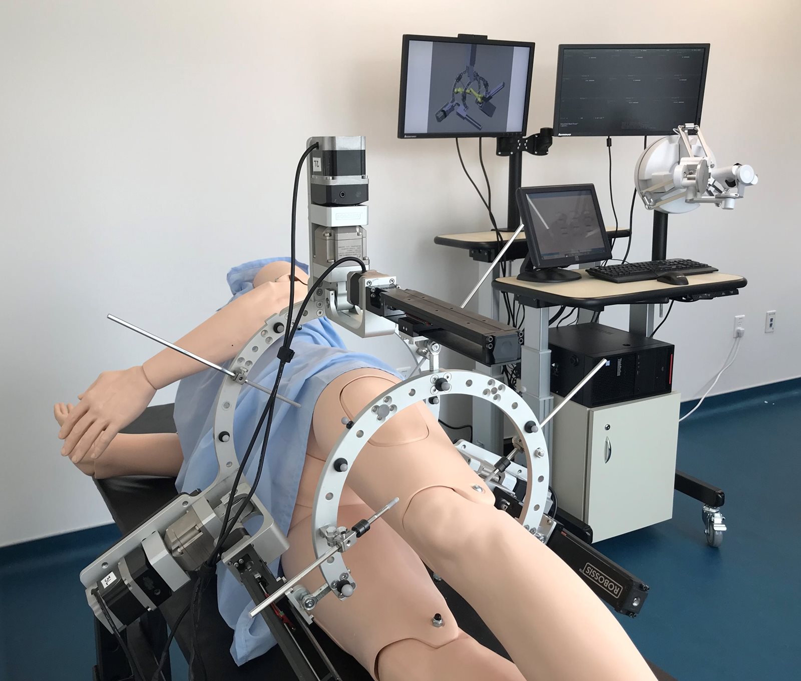 Robossis: Intelligent Surgical Robotic System for Long-Bone Fracture Alignment